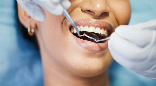 Best Emergency Treatment for Dental Infections or Abscesses in San Ysidro, NM